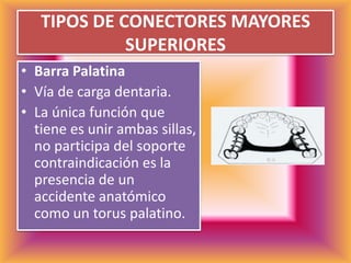 TIPOS DE CONECTORES MAYORES SUPERIORESBarra PalatinaVía de carga dentaria.La única función que tiene es unir ambas sillas, no participa del soporte contraindicación es la presencia de un accidente anatómico como un torus palatino.