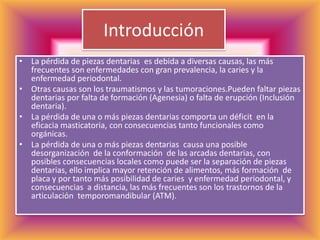 IntroducciónLa pérdida de piezas dentarias  es debida a diversas causas, las más frecuentes son enfermedades con gran prevalencia, la caries y la enfermedad periodontal. Otras causas son los traumatismos y las tumoraciones.Pueden faltar piezas dentarias por falta de formación (Agenesia) o falta de erupción (Inclusión dentaria). La pérdida de una o más piezas dentarias comporta un déficit  en la eficacia masticatoria, con consecuencias tanto funcionales como orgánicas. La pérdida de una o más piezas dentarias  causa una posible desorganización  de la conformación  de las arcadas dentarias, con posibles consecuencias locales como puede ser la separación de piezas dentarias, ello implica mayor retención de alimentos, más formación  de placa y por tanto más posibilidad de caries  y enfermedad periodontal, y consecuencias  a distancia, las más frecuentes son los trastornos de la articulación  temporomandibular (ATM).