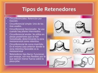 Tipos de RetenedoresCircunferenciales: Retención por tracción.Circunferencial simple: Uno de los mas usados.Circunferencial Seccionado:  Se usa cuando hay pilares intermedios Circunferencial anular: Se utiliza en piezas posteriores que se han mesializado, determinando la zona mesiocervical como retentiva.Circunferencial de curva invertida: En el mismo caso anterior donde la zona retentiva favorable es la mesiocervicalRetenedores tipo Barra: Funcionan por empuje, son mas flexibles por lo que ejercen menor fuerza sobre la pieza pilar.                                   