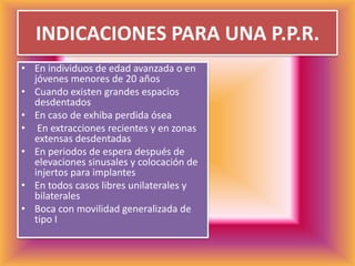 INDICACIONES PARA UNA P.P.R.En individuos de edad avanzada o en jóvenes menores de 20 años Cuando existen grandes espacios desdentadosEn caso de exhiba perdida ósea En extracciones recientes y en zonas extensas desdentadasEn periodos de espera después de elevaciones sinusales y colocación de injertos para implantesEn todos casos libres unilaterales y bilateralesBoca con movilidad generalizada de tipo I