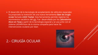 2.- CIRUGÍA OCULAR
 El desarrollo de la tecnología de acoplamiento de vehículos espaciales
ha propiciado la invención de una nueva herramienta láser de cirugía
ocular llamada LADA Tracker. Esta herramienta permite registrar los
movimientos sacádicos del ojo. Fue desarrollada por los Laboratorios
Alcon en Texas a partir de la tecnología espacial y se usa junto con el
sistema LADARVision de la misma compañía para hacer las
intervenciones oculares por láser.
 