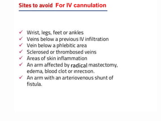 For IV cannulation
radical
 