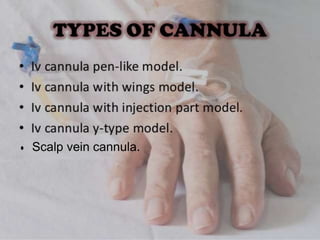 Scalp vein cannula.
 
