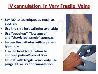 IV cannulation in Very Fragile Veins
• Say NO to tourniquet as much as
possible
• Use the smallest catheter available
• Use “bevel-up”, “low angle”
and “slowly but surely” approach
• Secure the catheter with a paper-
type tape
• Provide health education to
improve patient’s condition
• Patient with fragile veins only use
gauge 20 or 22 for cannulation
 