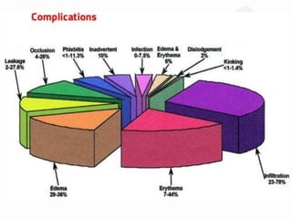 Unknown facts about iv cannulation
