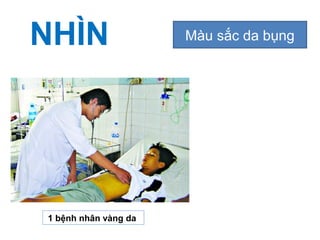 NHÌN Màu sắc da bụng
1 bệnh nhân vàng da
 