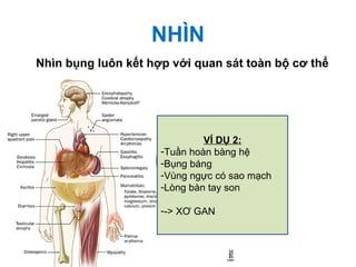 NHÌN
Nhìn bụng luôn kết hợp với quan sát toàn bộ cơ thể
VÍ DỤ 2:
-Tuần hoàn bàng hệ
-Bụng báng
-Vùng ngực có sao mạch
-Lòng bàn tay son
--> XƠ GAN
 