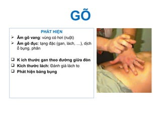 GÕ
PHÁT HIỆN
 Âm gõ vang: vùng có hơi (ruột)
 Âm gõ đục: tạng đặc (gan, lách, …), dịch
ổ bụng, phân
 K ích thước gan theo đường giữa đòn
 Kích thước lách: Đánh giá lách to
 Phát hiện báng bụng
 