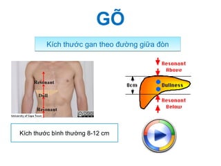 Kích thước gan theo đường giữa đònKích thước gan theo đường giữa đòn
Kích thước bình thường 8-12 cm
GÕ
 