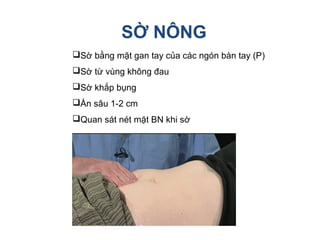 SỜ NÔNG
Sờ bằng mặt gan tay của các ngón bàn tay (P)
Sờ từ vùng không đau
Sờ khắp bụng
Ấn sâu 1-2 cm
Quan sát nét mặt BN khi sờ
 