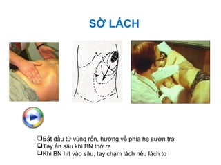 SỜ LÁCH
Bắt đầu từ vùng rốn, hướng về phía hạ sườn trái
Tay ấn sâu khi BN thở ra
Khi BN hít vào sâu, tay chạm lách nếu lách to
 