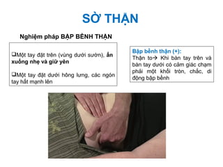 Nghiệm pháp BẬP BỀNH THẬN
Một tay đặt trên (vùng dưới sườn), ấn
xuống nhẹ và giữ yên
Một tay đặt dưới hông lưng, các ngón
tay hất mạnh lên
SỜ THẬN
Bập bềnh thận (+):
Thận to Khi bàn tay trên và
bàn tay dưới có cảm giác chạm
phải một khối tròn, chắc, di
động bập bềnh
 