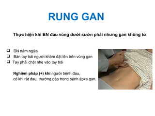 RUNG GAN
 BN nằm ngửa
 Bàn tay trái người khám đặt lên trên vùng gan
 Tay phải chặt nhẹ vào tay trái
Nghiệm pháp (+) khi người bệnh đau,
có khi rất đau, thường gặp trong bệnh ápxe gan.
Thực hiện khi BN đau vùng dưới sườn phải nhưng gan không to
 