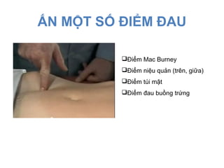 ẤN MỘT SỐ ĐIỂM ĐAU
Điểm Mac Burney
Điểm niệu quản (trên, giữa)
Điểm túi mật
Điểm đau buồng trứng
 