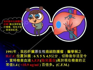 突然發作右側腰部
好痛! 無法深呼吸、
打噴嚏、哈哈大笑
。尿液如紅茶。




 1991年，我的肝臟原生性癌細胞腫瘤；醫學稱之
 H.C.C.位置如圖 : 6 X 5 X 4.5公分，切除後存活至今
 。當時檢查血液A.F.P.(胎兒蛋白)高於現在檢查的正
 常值1.4 ( <10.9 ng/ml ) 百倍多。(C.F.M.)
 