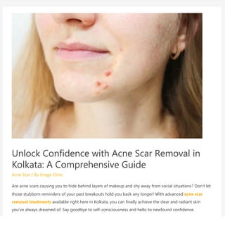 Unlock Confidence with Acne Scar Removal in
Kolkata: A Comprehensive Guide
Acne Scar / By Image Clinic
Are acne scars causing you to hide behind layers of makeup and shy away from social situations? Don’t let
those stubborn reminders of your past breakouts hold you back any longer! With advanced acne scar
removal treatments available right here in Kolkata, you can finally achieve the clear and radiant skin
you’ve always dreamed of. Say goodbye to self-consciousness and hello to newfound confidence.
 