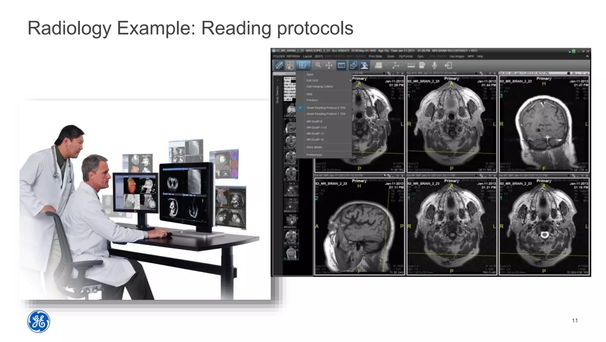 11
Radiology Example: Reading protocols
 