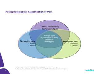 19
Pathophysiological Classification of Pain
Freynhagen R, Baron R. Curr Pain Headache Rep 2009; 13(3):185-90; Jensen TS et al. Pain 2011; 152(10):2204-5;
Julius D et al. In: McMahon SB, Koltzenburg M (eds). Wall and Melzack’s Textbook of Pain. 5th ed. Elsevier; London, UK: 2006;
Ross E. Expert Opin Pharmacother 2001; 2(1):1529-30; Webster LR. Am J Manag Care 2008; 14(5 Suppl 1):S116-22; Woolf CJ. Pain 2011; 152(3 Suppl):S2-15.
Multiple types
of pain coexist in many
conditions
(mixed pain)Nociceptive pain
- Somatic
- Visceral
Neuropathic pain
- Peripheral
- Central
Central sensitization/
dysfunctional pain
 