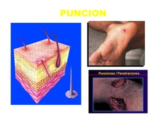PUNCION