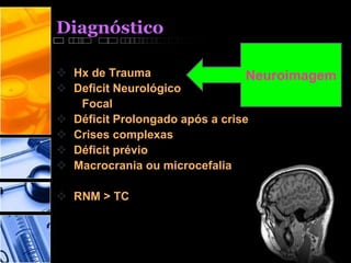 Diagnóstico
 Hx de Trauma
 Deficit Neurológico
Focal
 Déficit Prolongado após a crise
 Crises complexas
 Déficit prévio
 Macrocrania ou microcefalia
 RNM > TC
Neuroimagem
 