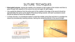 SUTURE TECHIQUES
• Interrupted sutures- require the needle to be inserted at right angles to the incision and then to
pass through both aspects of the suture line and exit again at right angles.
• As a guide,the distance from the entry point of the needle to the edge of the wound should be
approximately the same as the depth of the tissue being sutured, and each successive suture
should be placed at twice this distance apart .
• In linear wounds, it is sometimes easier to insert the middle suture first and then to complete the
closure by successively inserting sutures, halving the remaining deficits in the wound length.
 