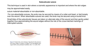 This technique is used in skin where a cosmetic appearance is important and where the skin edges
may be approximated easily.
suture material=absorbable or non-absorbable.
For non-absorbable sutures, the ends may be secured by means of a collar and bead, or tied loosely
over the wound. When absorbable sutures are used, the ends may be secured using a buried knot.
Small bites of the subcuticular tissues are taken on alternate sites of the wound and then gently pulled
together thus approximating the wound edges without the risk of the cross-hatched markings of
interrupted sutures.
Subcuticular suture
 