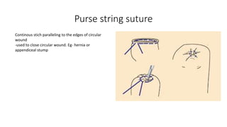 Purse string suture
Continous stich paralleling to the edges of circular
wound
-used to close circular wound. Eg- hernia or
appendiceal stump
 