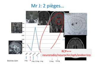 Mr J: 2 pièges…
Dostinex /sem 1mg 1mg 1,5mg 2mg 1,5mg
0
500
1000
1500
2000
2500
3000
3500
prolactine (µg/l)
0,5mg
RCP+++
neuroradio/neurochir/oph/endocrino
 