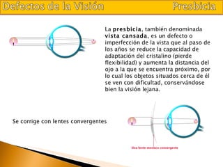 La  presbicia , también denominada  vista cansada , es un defecto o imperfección de la vista que al paso de los años se reduce la capacidad de adaptación del cristalino (pierde flexibilidad) y aumenta la distancia del ojo a la que se encuentra próximo, por lo cual los objetos situados cerca de él se ven con dificultad, conservándose bien la visión lejana. Se corrige con lentes convergentes 