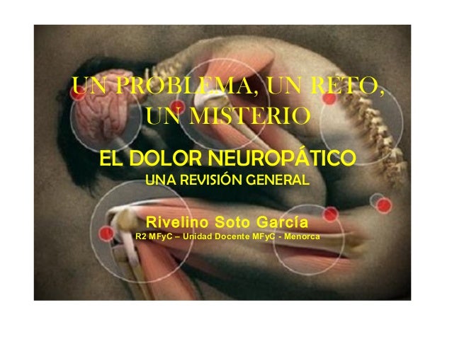 pastillas para el dolor de espalda se explica