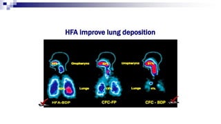 HFA improve lung deposition
 