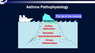 Airway
inflammation
Airflow
obstruction
Bronchial
hyperresponsiveness
Symptoms
Asthma Pathophysiology
The tip of the iceberg
 