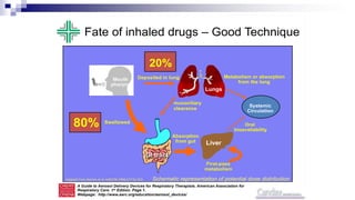 78
Fate of inhaled drugs – Good Technique
Swallowed
GI tract
Deposited in lung
Lungs
Metabolism or absorption
from the lung
Liver
Oral
bioavailability
Absorption
from gut
First-pass
metabolism
Systemic
Circulation
Mouth
pharynx
mucociliary
clearance
80%
20%
Schematic representation of potential dose distribution
A Guide to Aerosol Delivery Devices for Respiratory Therapists. American Association for
Respiratory Care. 1st Edition. Page 1.
Webpage: http://www.aarc.org/education/aerosol_devices/
Adapted from Barnes et al. AJRCCM 1998;157:S1-S53
 