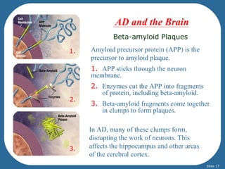 AD and the Brain
             Beta-amyloid Plaques

1.   Amyloid precursor protein (APP) is the
     precursor to amyloid plaque.
     1. APP sticks through the neuron
     membrane.
     2. Enzymes cut the APP into fragments
        of protein, including beta-amyloid.
2.
     3. Beta-amyloid fragments come together
        in clumps to form plaques.

     In AD, many of these clumps form,
     disrupting the work of neurons. This
3.   affects the hippocampus and other areas
     of the cerebral cortex.
                                               Slide 17
 