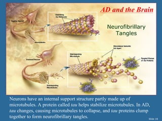 AD and the Brain

                                                   Neurofibrillary
                                                     Tangles




Neurons have an internal support structure partly made up of
microtubules. A protein called tau helps stabilize microtubules. In AD,
tau changes, causing microtubules to collapse, and tau proteins clump
together to form neurofibrillary tangles.                             Slide 18
 