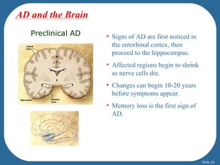 AD and the Brain
   Preclinical AD   • Signs of AD are first noticed in
                      the entorhinal cortex, then
                      proceed to the hippocampus.
                    • Affected regions begin to shrink
                      as nerve cells die.
                    • Changes can begin 10-20 years
                      before symptoms appear.
                    • Memory loss is the first sign of
                      AD.




                                                         Slide 20
 