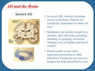 AD and the Brain
    Severe AD
                   • In severe AD, extreme shrinkage
                     occurs in the brain. Patients are
                     completely dependent on others for
                     care.
                   • Symptoms can include weight loss,
                     seizures, skin infections, groaning,
                     moaning, or grunting, increased
                     sleeping, loss of bladder and bowel
                     control.
                   • Death usually occurs from
                     aspiration pneumonia or other
                     infections. Caregivers can turn to a
                     hospice for help and palliative care.

                                                        Slide 22
 