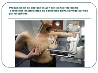 Probabilidad de que una mujer con cáncer de mama
detectado en programa de screening haya salvado su vida
por el cribado
 