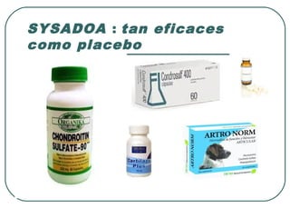 SYSADOA : tan eficaces
como placebo
 