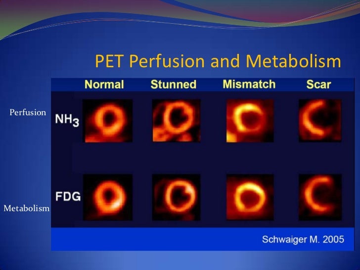 Unresolved Issues In Myocardial Viability Unresolved Issues In Myocardial Viability