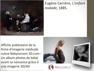 Eugène Carrière, L’enfant
malade, 1885.
Affiche publicitaire de la
firme d'imagerie médicale
suisse Babycocoon 3D.com :
Un album photos de bébé
avant sa naissance grâce à
une imagerie 3D/4D
 