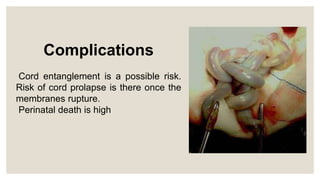 Complications
Cord entanglement is a possible risk.
Risk of cord prolapse is there once the
membranes rupture.
Perinatal death is high
 