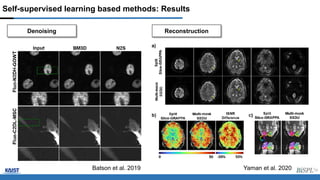Self-supervised learning based methods: Results
Denoising
Yaman et al. 2020
Batson et al. 2019
Reconstruction
 