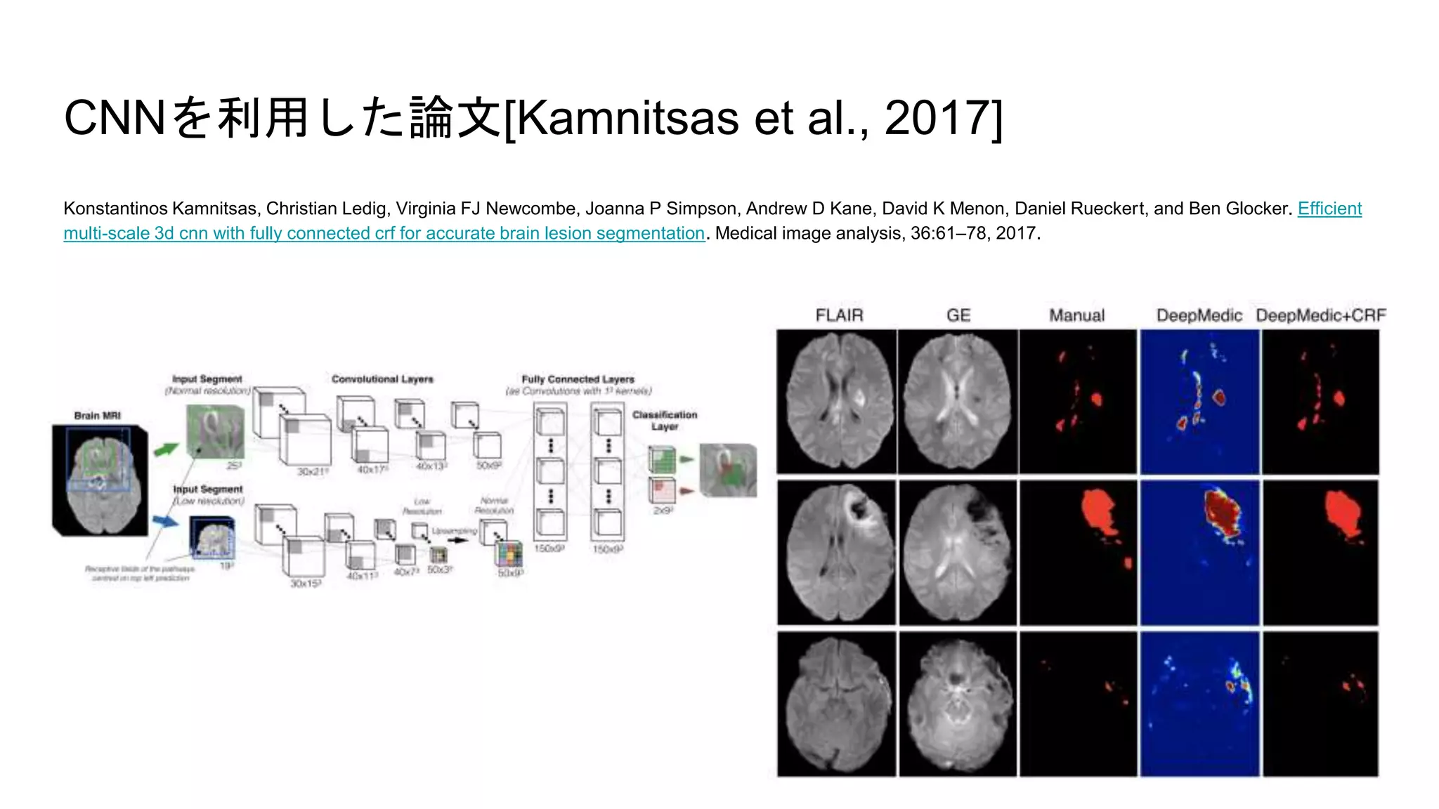 CNNを利用した論文[Kamnitsas et al., 2017]
Konstantinos Kamnitsas, Christian Ledig, Virginia FJ Newcombe, Joanna P Simpson, Andrew D Kane, David K Menon, Daniel Rueckert, and Ben Glocker. Efficient
multi-scale 3d cnn with fully connected crf for accurate brain lesion segmentation. Medical image analysis, 36:61–78, 2017.
 