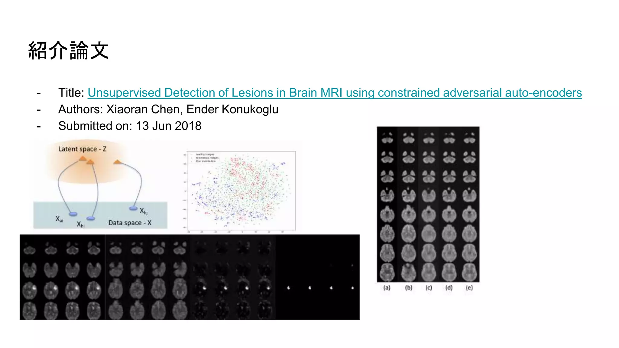 紹介論文
- Title: Unsupervised Detection of Lesions in Brain MRI using constrained adversarial auto-encoders
- Authors: Xiaoran Chen, Ender Konukoglu
- Submitted on: 13 Jun 2018
 