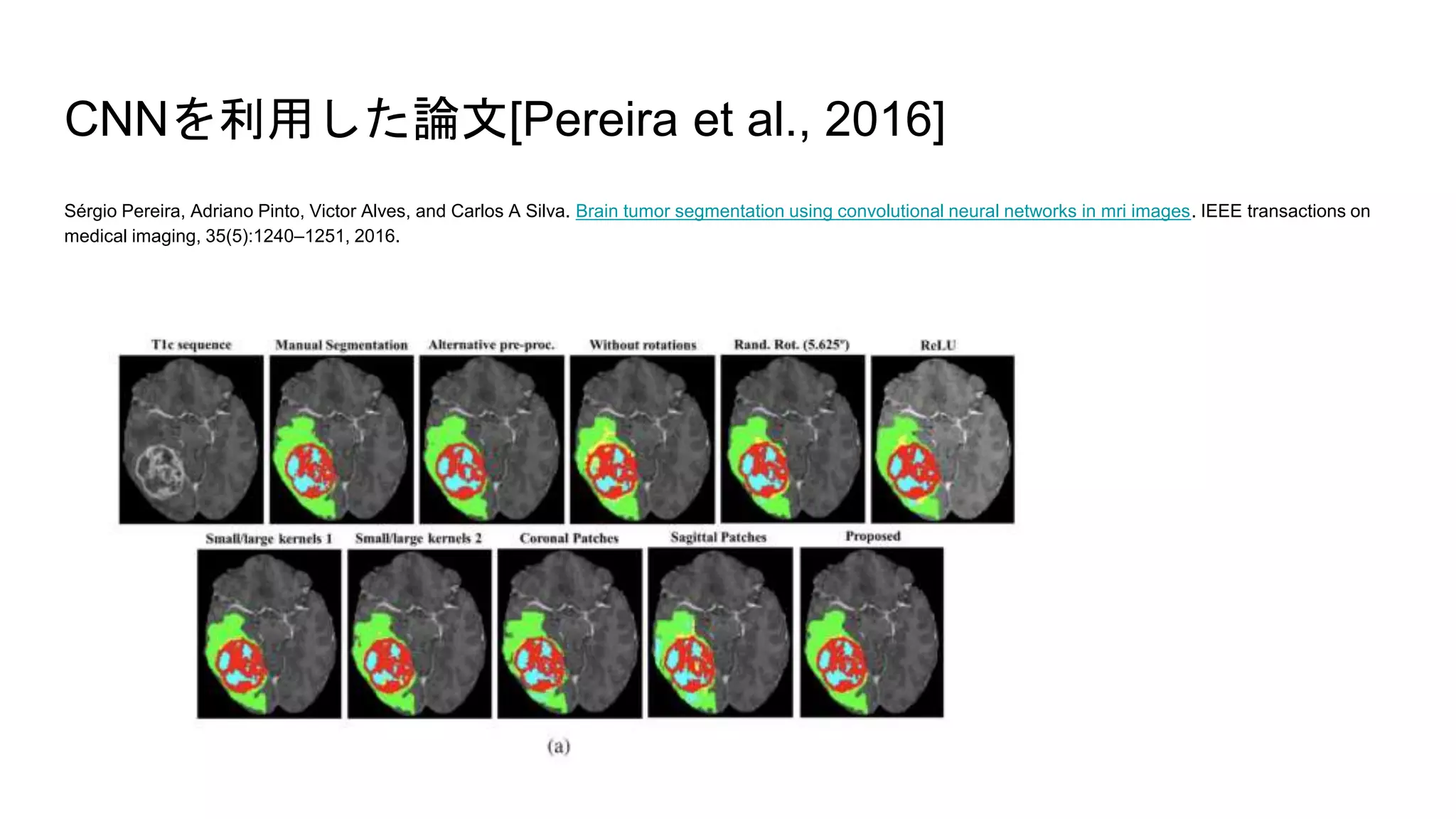 CNNを利用した論文[Pereira et al., 2016]
Sérgio Pereira, Adriano Pinto, Victor Alves, and Carlos A Silva. Brain tumor segmentation using convolutional neural networks in mri images. IEEE transactions on
medical imaging, 35(5):1240–1251, 2016.
 
