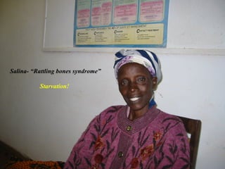 Salina- “Rattling bones syndrome”

                Starvation!




 July 9, 2012
 