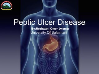 Peptic Ulcer Disease
By:Rezhwan Omer Jwamer
University Of Sulaimani
 