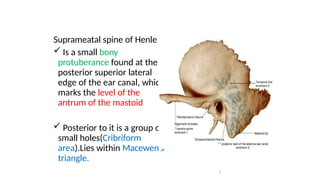 Untitled (6) [Autosaved] ear.pptx ear surgeries | PPTX