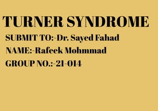 TURNER SYNDROME
SUBMIT TO:-Dr. Sayed Fahad
NAME:-Rafeek Mohmmad
GROUP NO.:-21-014
 